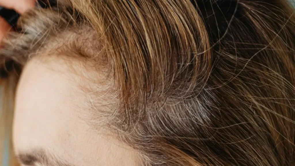 mudanças capilares na mulher 40+