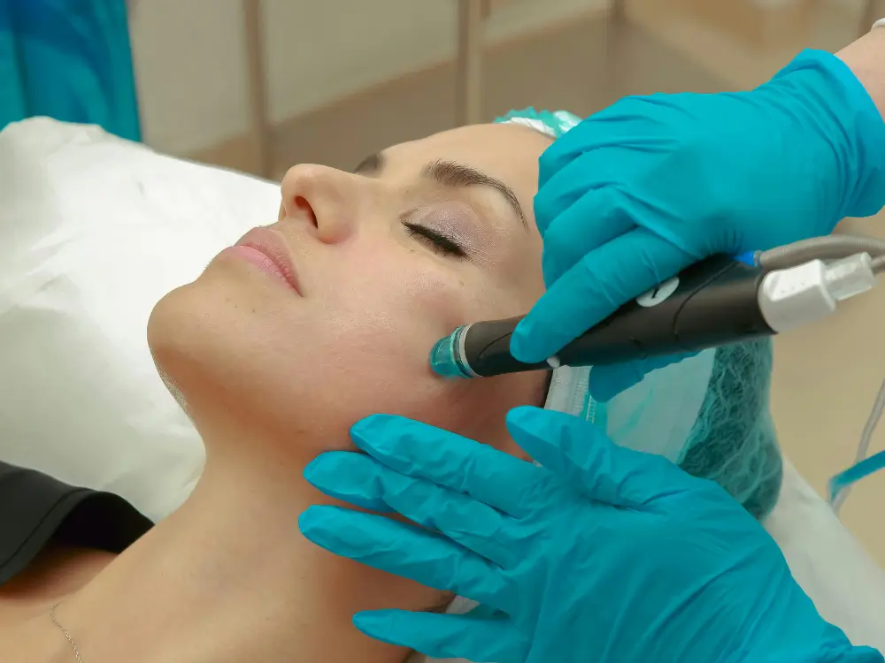 serlevve - 2025-12-03T224803.325 Laser fracionado para tratamento de manchas e rugas em pele madura