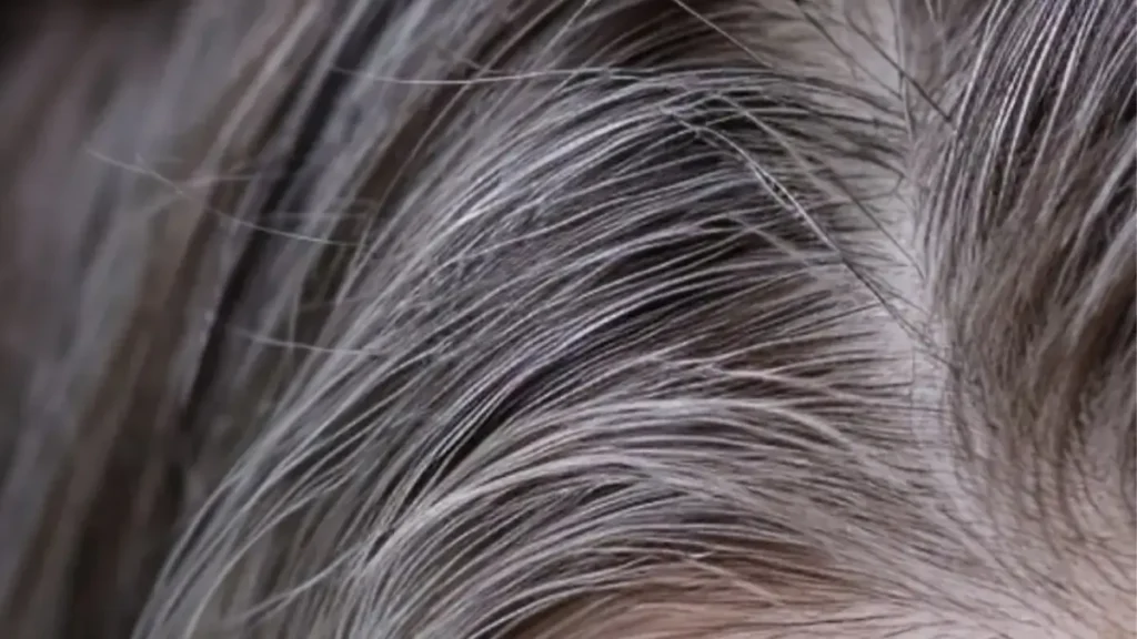 Cabelo branco resistente com aspecto vidrado em mulher de 40 anos.